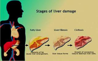 Liver Diet