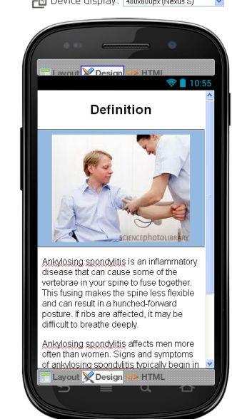 Ankylosing Spondylitis Disease