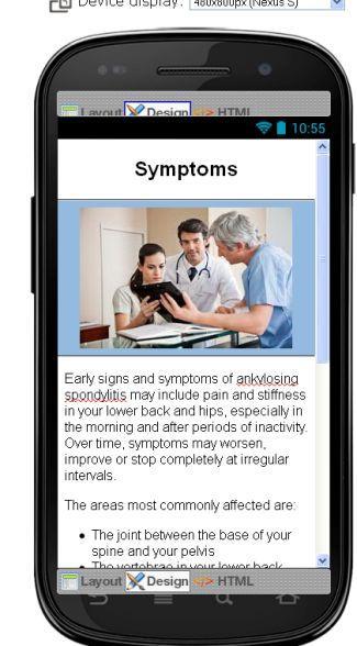 Ankylosing Spondylitis Disease