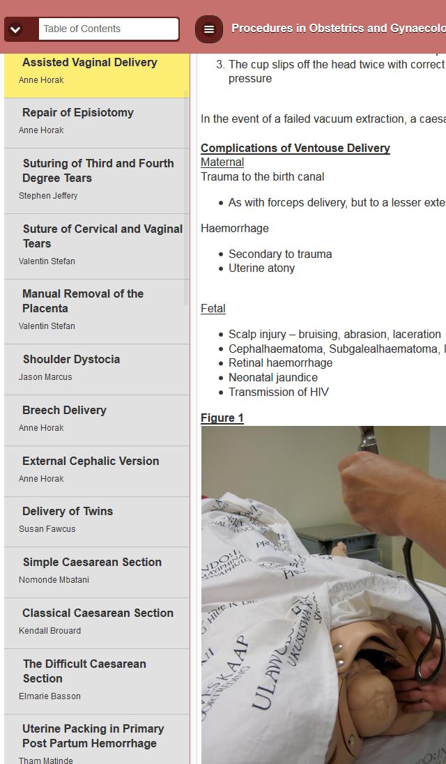 Procedures in O&G