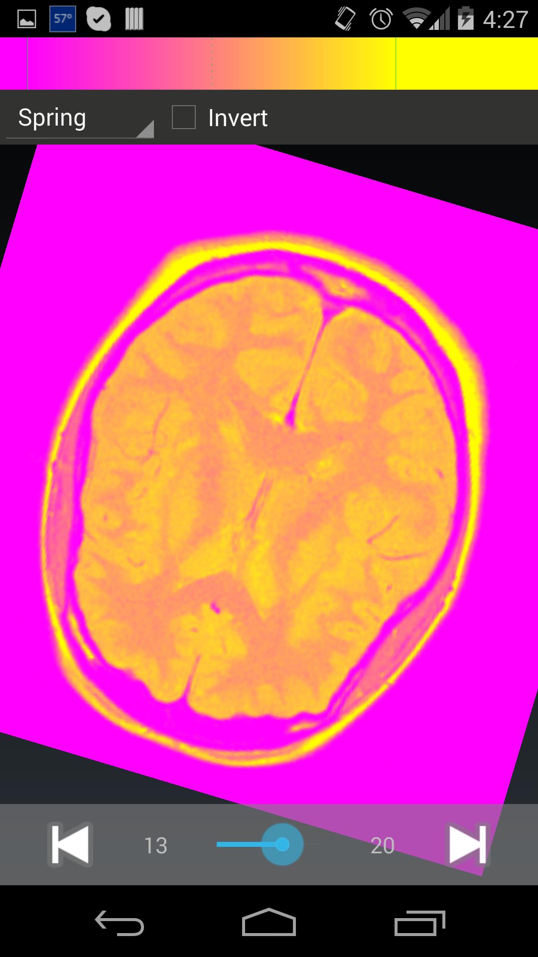 simplyDICOM Viewer