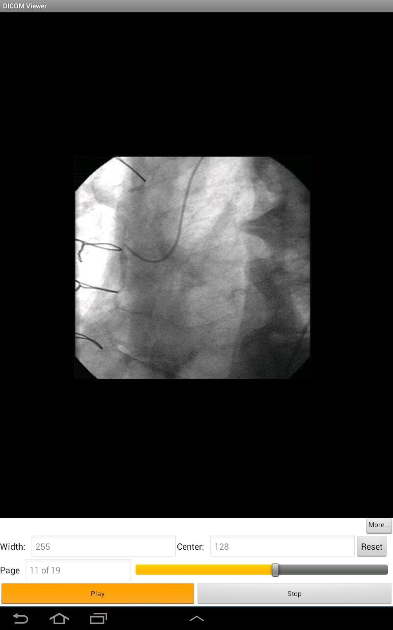 LEADTOOLS DICOM Viewer App