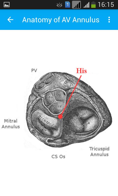 Health care Tools - EP++