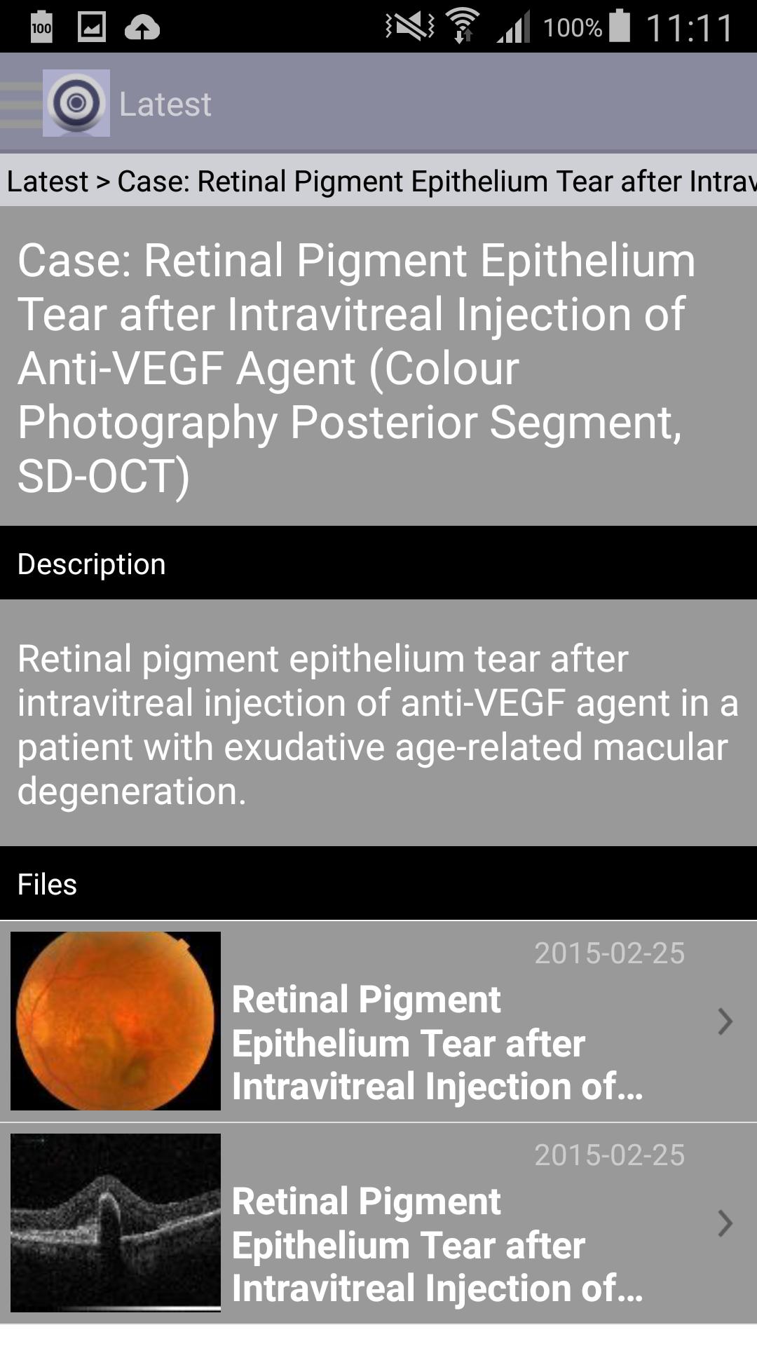 Atlas of Ophthalmology Onjoph