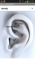 Ear Acupuncture