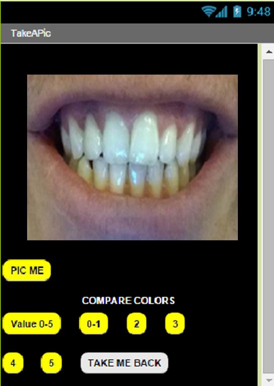 Whitening At Home(WAH)