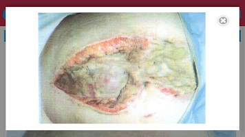 Surgery UCT