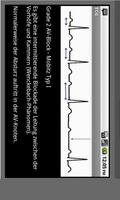 Elektrokardiogramm EKG Typen